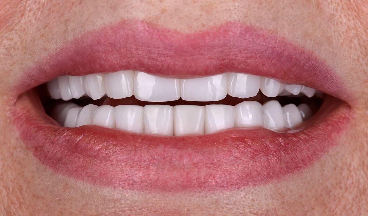 Видалення зубів з ускладненим карієсом