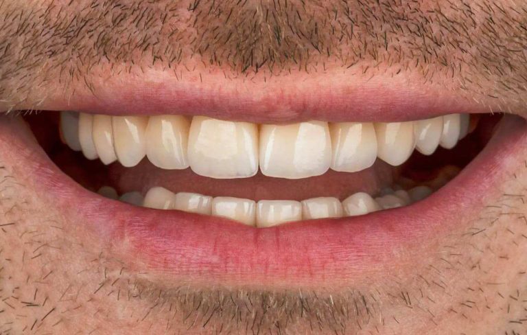 keramichni-restavraciyi-6