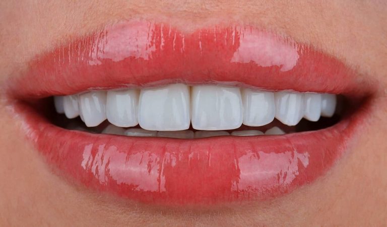 Excellent prosthetic result in a complex clinical case