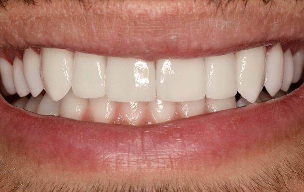 Зміна кольору і форми зубів