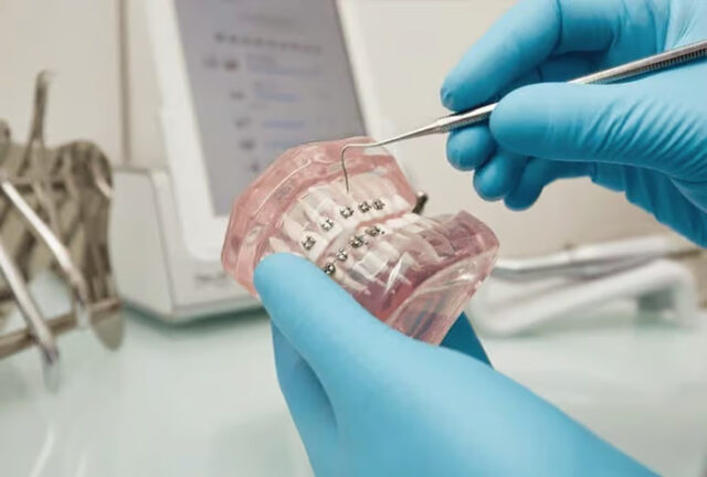 Перекрестный прикус