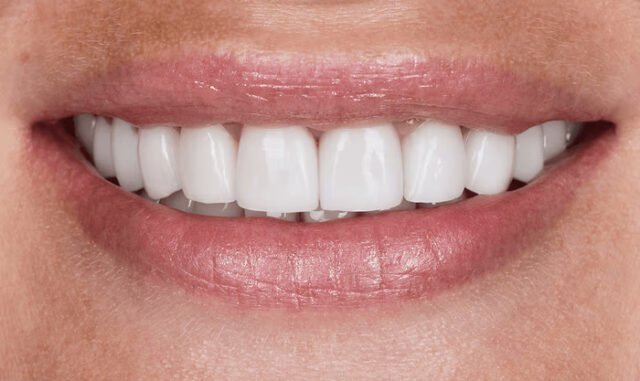 Reconstructive Plastic Surgery