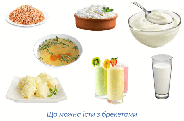Що можна їсти з брекетами