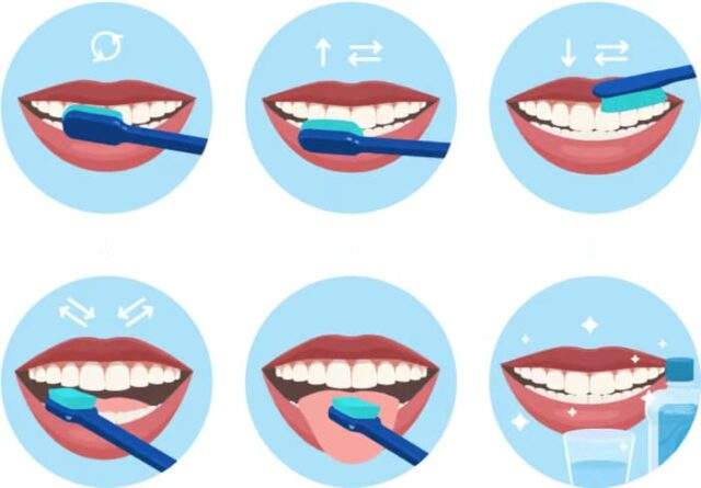 How to clean teeth after tooth extraction