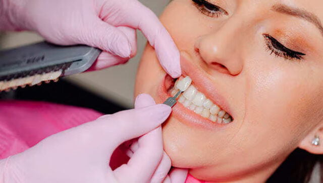 Cosmetic Correction of diastema