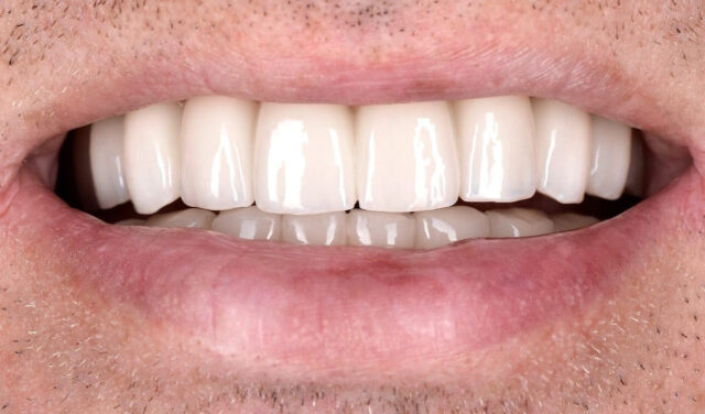 Домашние средства и меры предосторожности