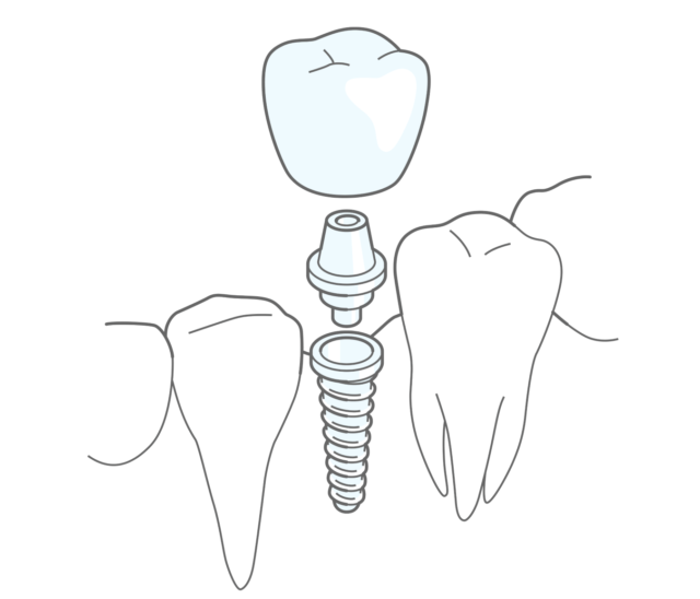 Tips for Keeping Long-Term Results Illustration