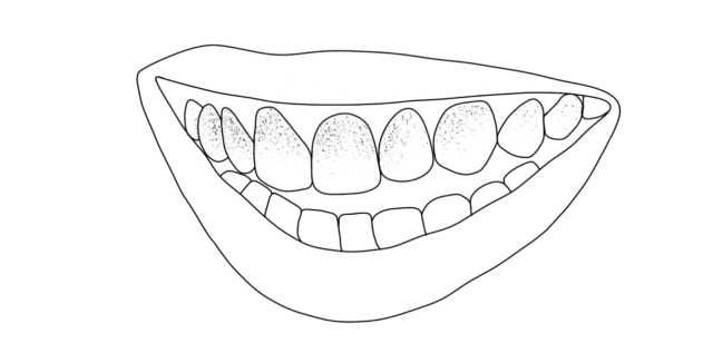 Tooth Decay Treatment Illustration