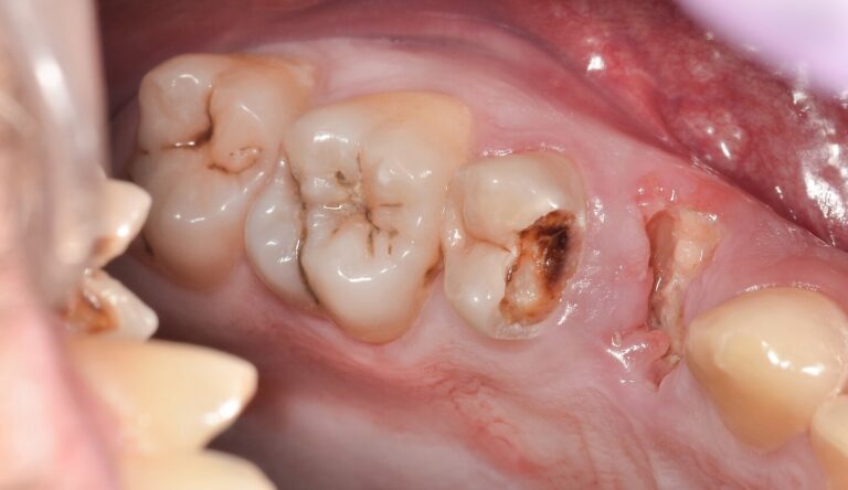 image-lk1-before