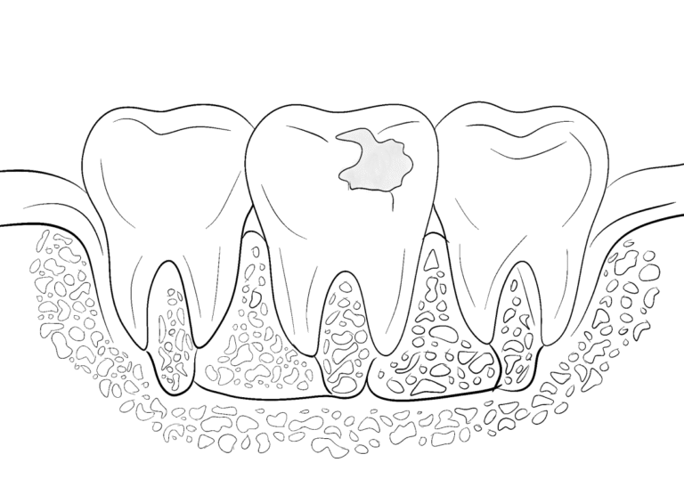 image-lk55