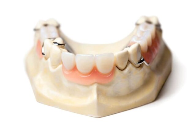 Лечение адентии