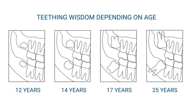 teething-wisdom-en