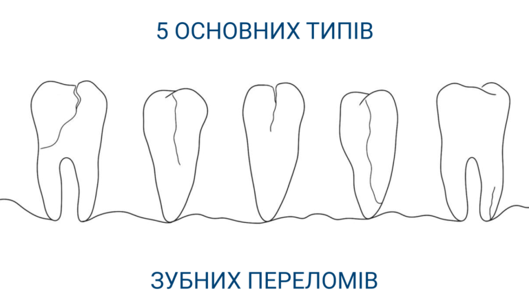 Зубні переломи
