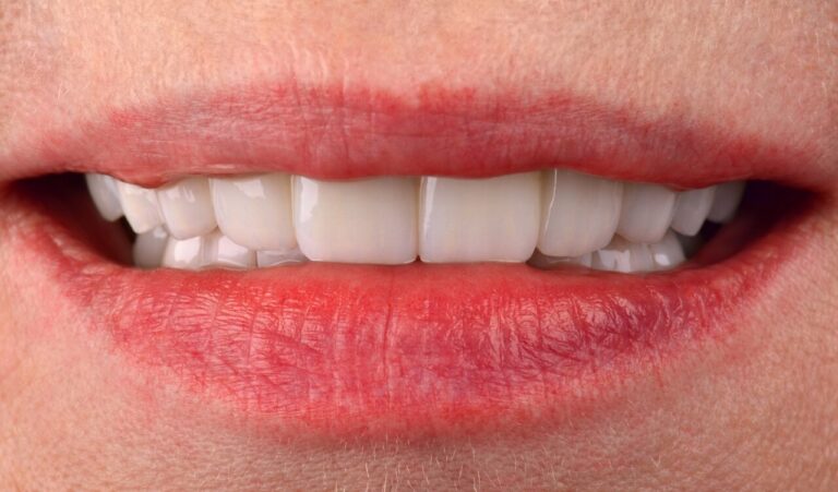 Implantological rehabilitation of a patient with complicated caries caused by improper prosthetics