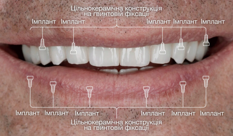 compare-photos-0000-2-3_UA