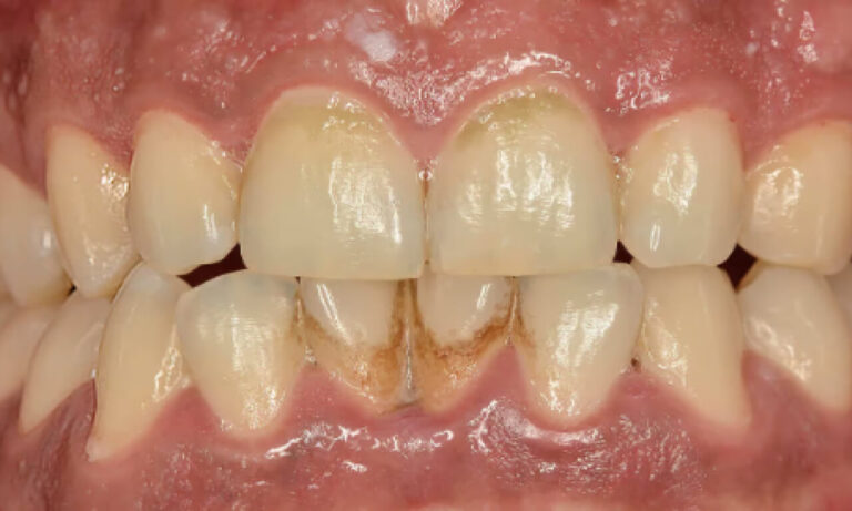 image-compare-1234-1