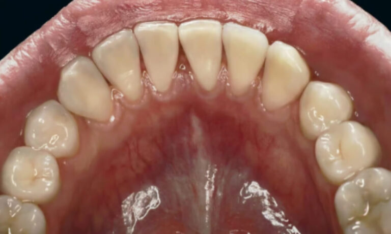 How does the Airflow method work?. Photo after