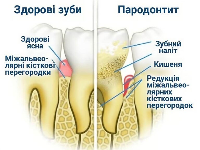 image_55-ua