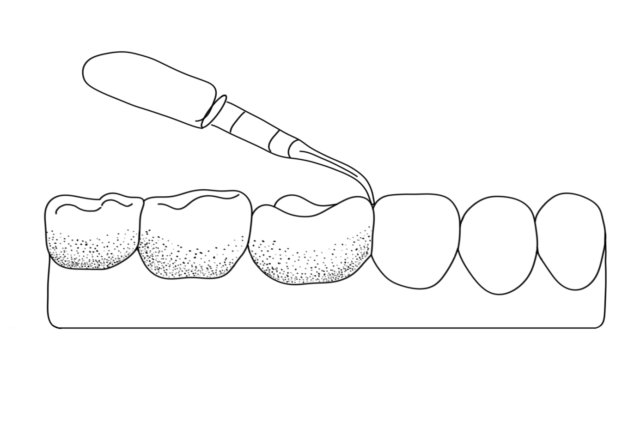 What is the Airflow procedure? Illustration