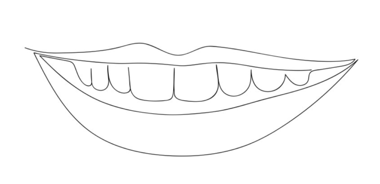 braces-image-098746