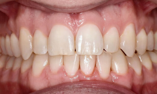 Our Services. Photo after