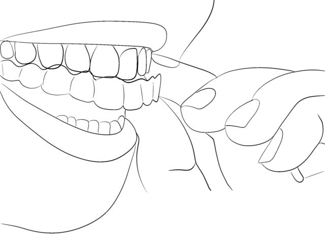 What are retainers? Illustration