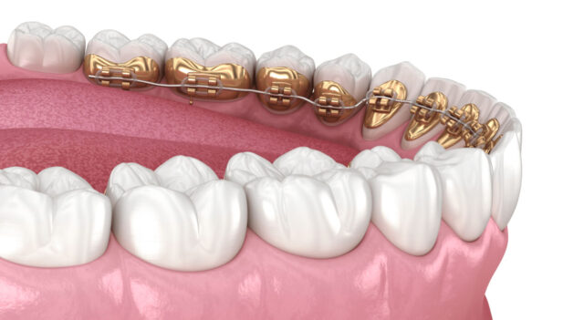 Indications for Use Illustration