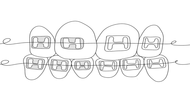 Benefits of Ceramic Braces Illustration
