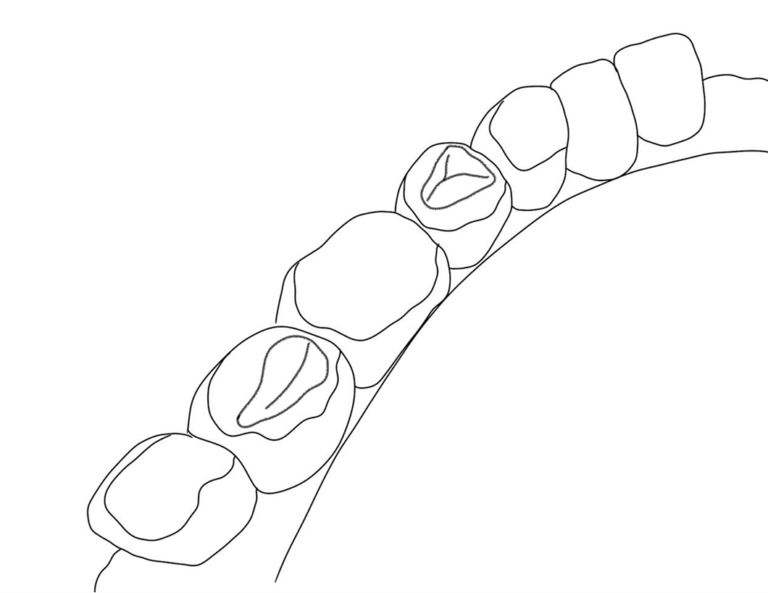 image-to2