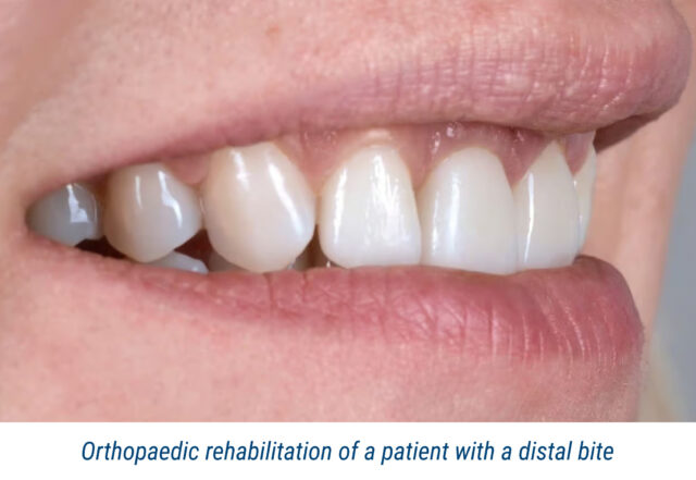 Orthopaedic rehabilitation of a patient with a distal bite