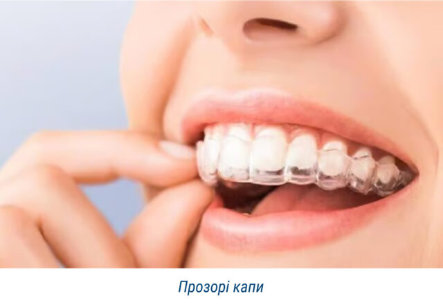 Прозорі капи