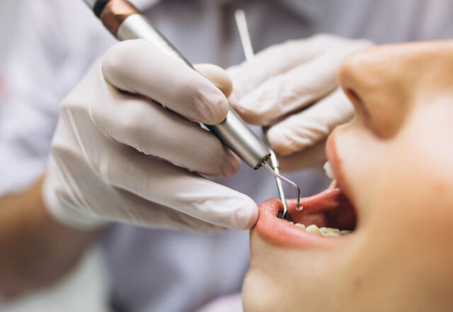 Types of fillings Illustration