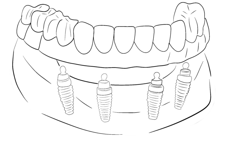image-qw337