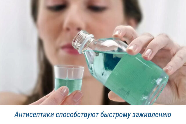 Антисептики способствуют быстрому заживлению