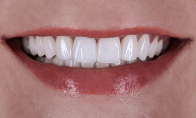 compare-photos-yhb573-2
