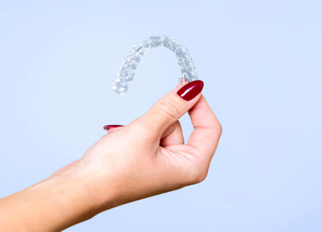 Advantages of aligners over braces Illustration