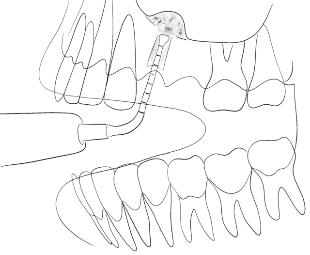 Indications for Maxillofacial Surgery Illustration