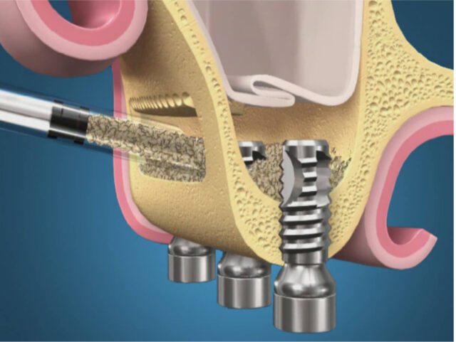 Contraindications Illustration