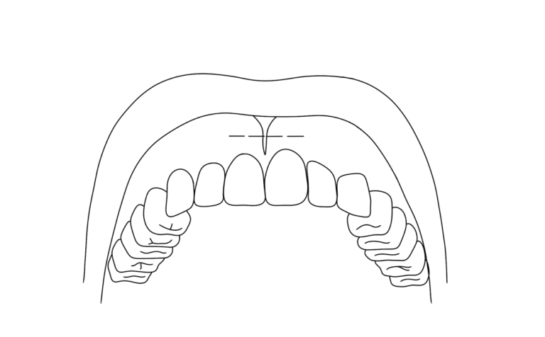 image-uft454