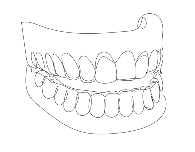 Nylon denture Illustration