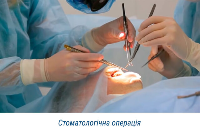 Стоматологічна операція 