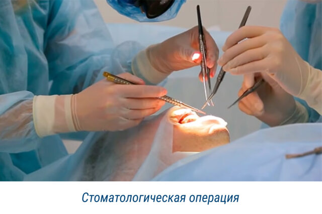 Стоматологическая операция