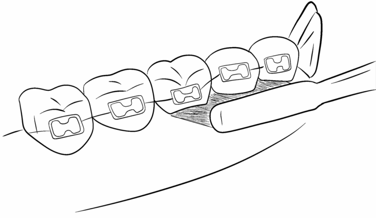 tempImageNVxPZC-1