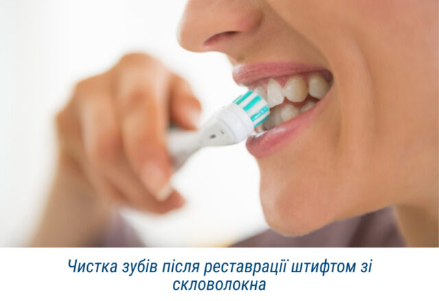 Чистка зубів після реставрації штифтом зі скловолокна