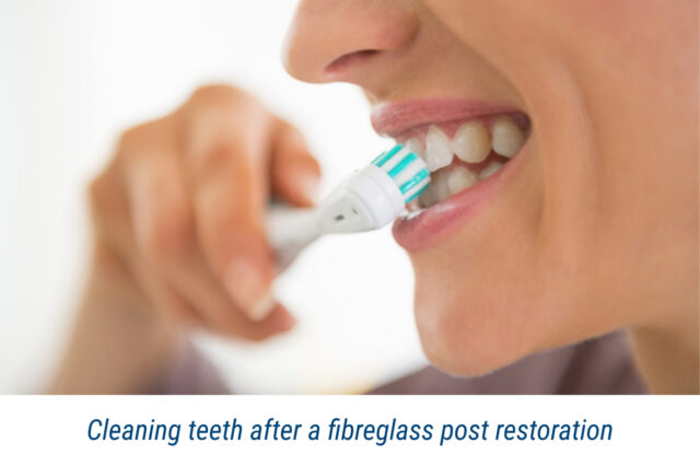 Cleaning teeth after a fibreglass post restoration