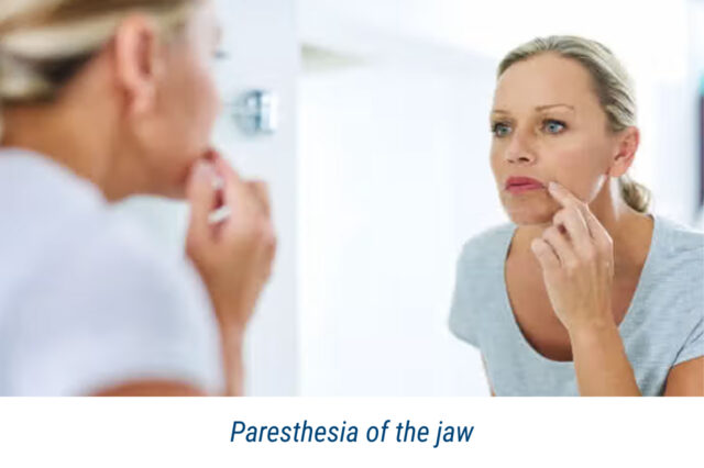 Paresthesia of the jaw