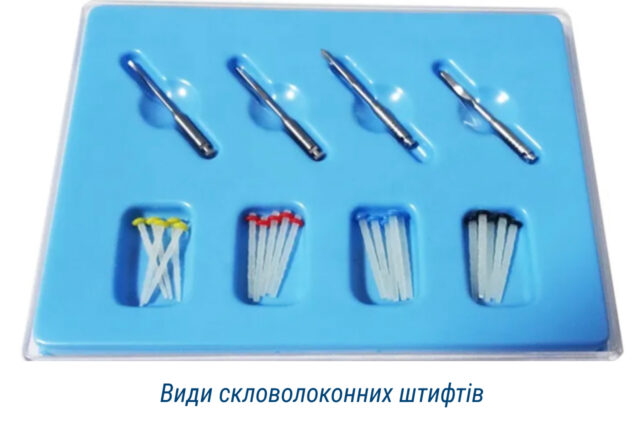 Види скловолоконних штифтів