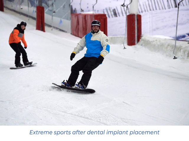 Extreme sports after dental implant placement