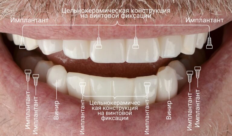 compare-photos-w2-2-ru