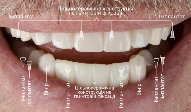 compare-photos-w2-2-ua